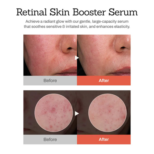 Retinova Skin Booster